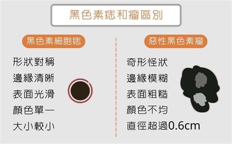 癦凸起|為什麼臉上的痣越來越多？皮膚科醫師解析長痣原因、。